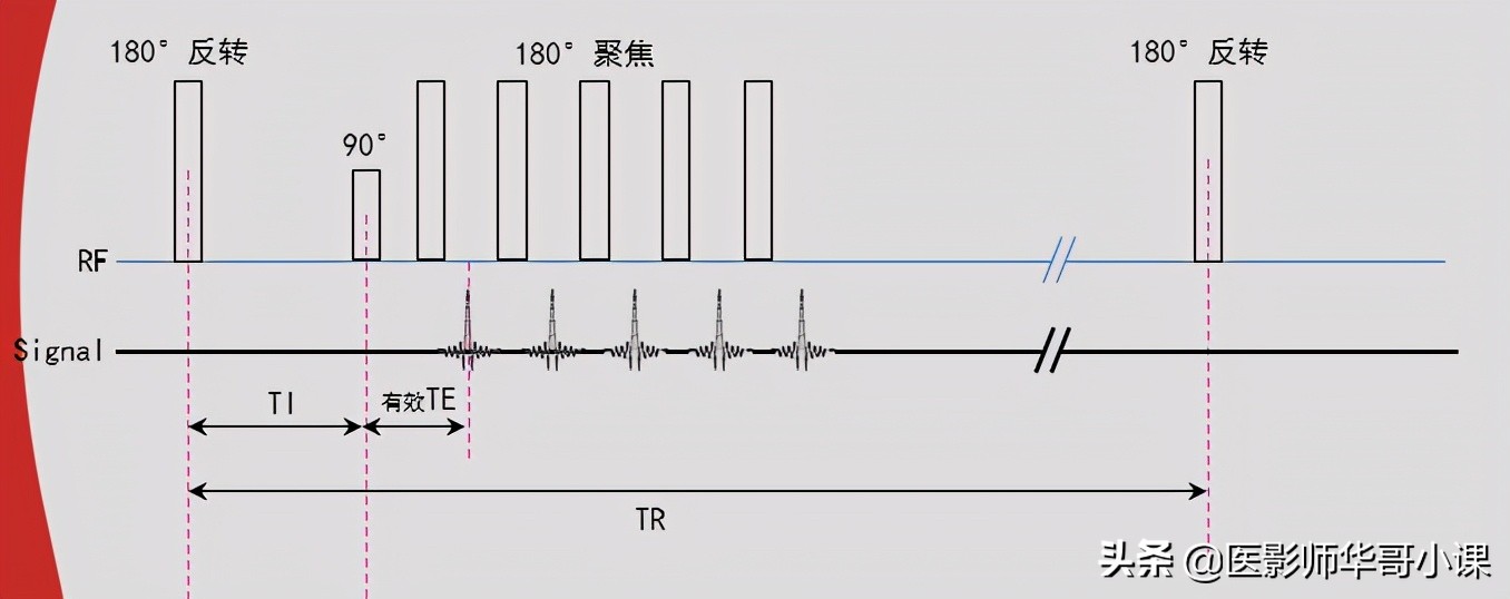磁共振mri序列参数解读,磁共振mrcp用哪些序列