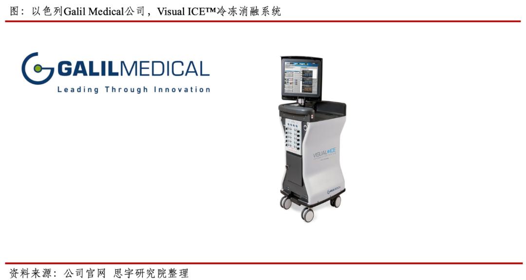 肿瘤冷冻消融治疗方法,肿瘤冷冻消融分析