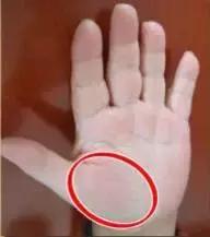 14种常见病的诊断方法,手诊10种常见病从手上就能看出来