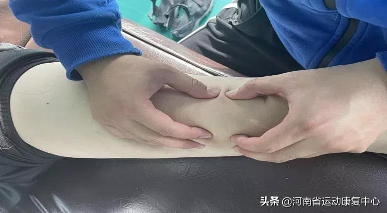 前交叉韧带断裂术后2-3周康复,膝盖交叉韧带断裂康复训练第三周