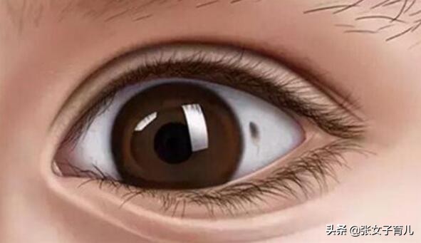 4岁宝宝眼白有黑点是怎么回事,三岁宝宝眼白有黑线是怎么回事