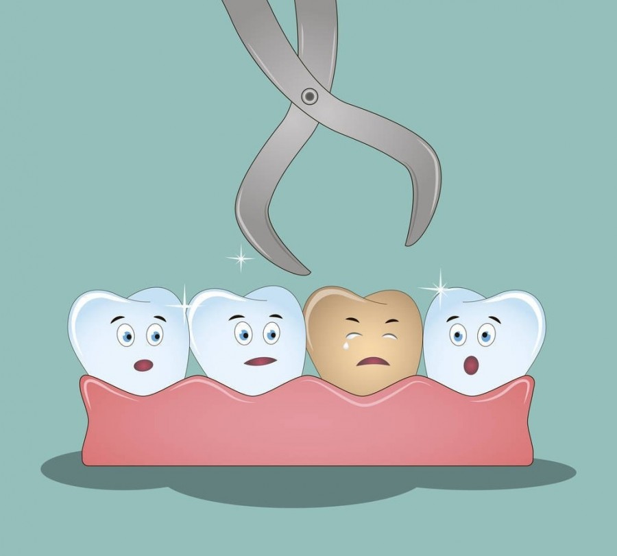 牙齿有一点点黑线怎么处理,牙齿上有黑线怎么补救