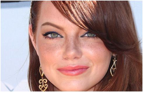 麻子草莓雀斑脸，欧阳娜娜祖儿示范小麻子如何从时尚毒药变新宠？