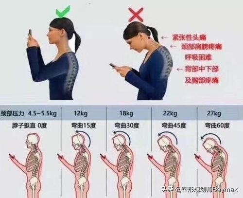 纠正颈部前伸最简单有效的方法,颈部前伸怎么办