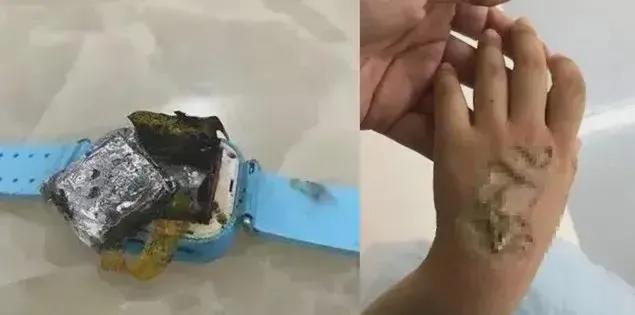 多少温度下儿童电话手表会自燃,儿童打电话手表发热有危险吗