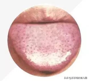 舌苔厚腻发白有红点是艾滋病吗,宝宝舌苔上有土怎么办