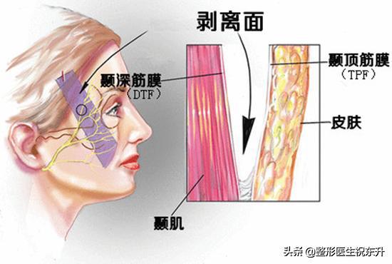 25岁脸垮有皱纹正常吗,面部衰老下垂的症状