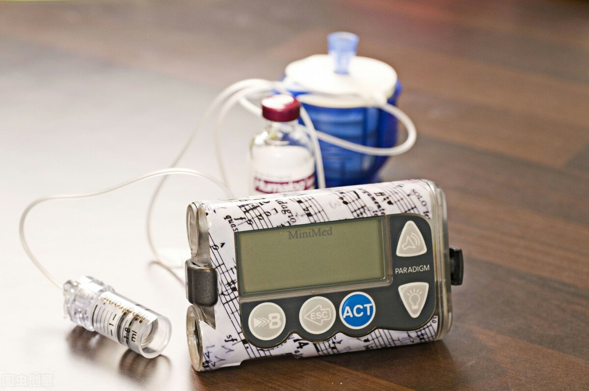 糖友年轻人注射胰岛素,二十几岁糖尿病打胰岛素寿命不长