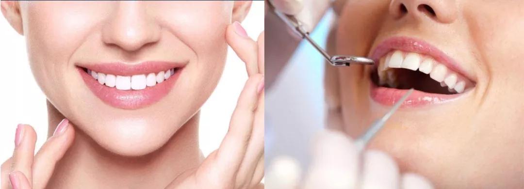 保护牙齿就是爱惜生命,爱护好牙齿才能吃更多好吃的东西