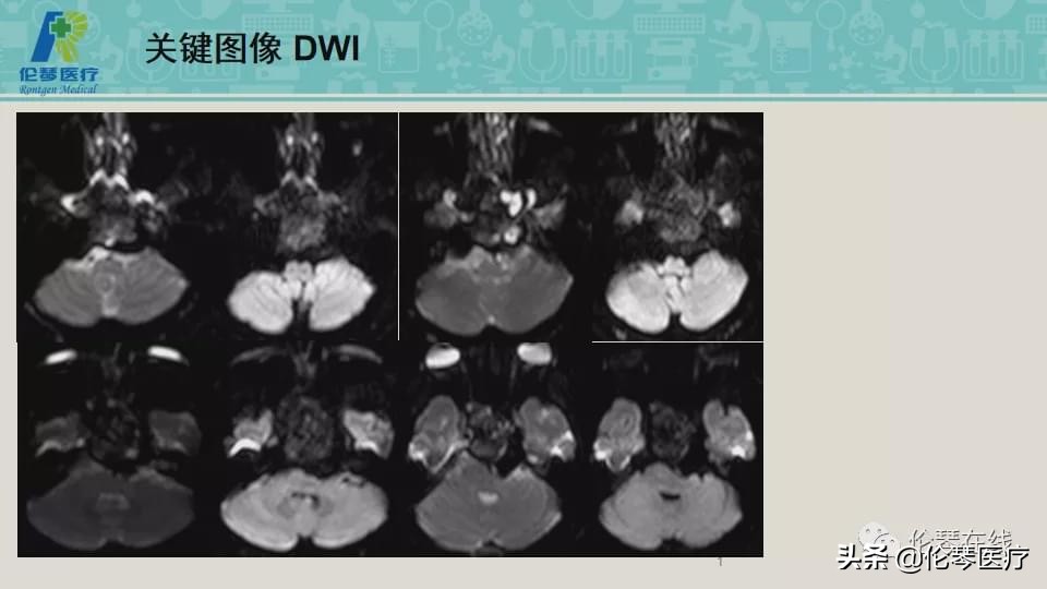 上海教授詹松华,上海曙光医院詹松华简介