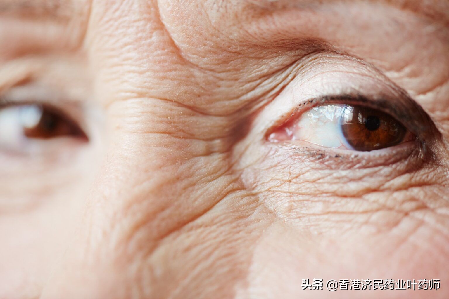 有临床意义的糖尿病黄斑水肿,糖尿病黄斑水肿研究进展