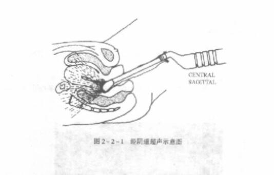 为什么去医院医生问有没有结婚,为什么检查会问有没有男朋友