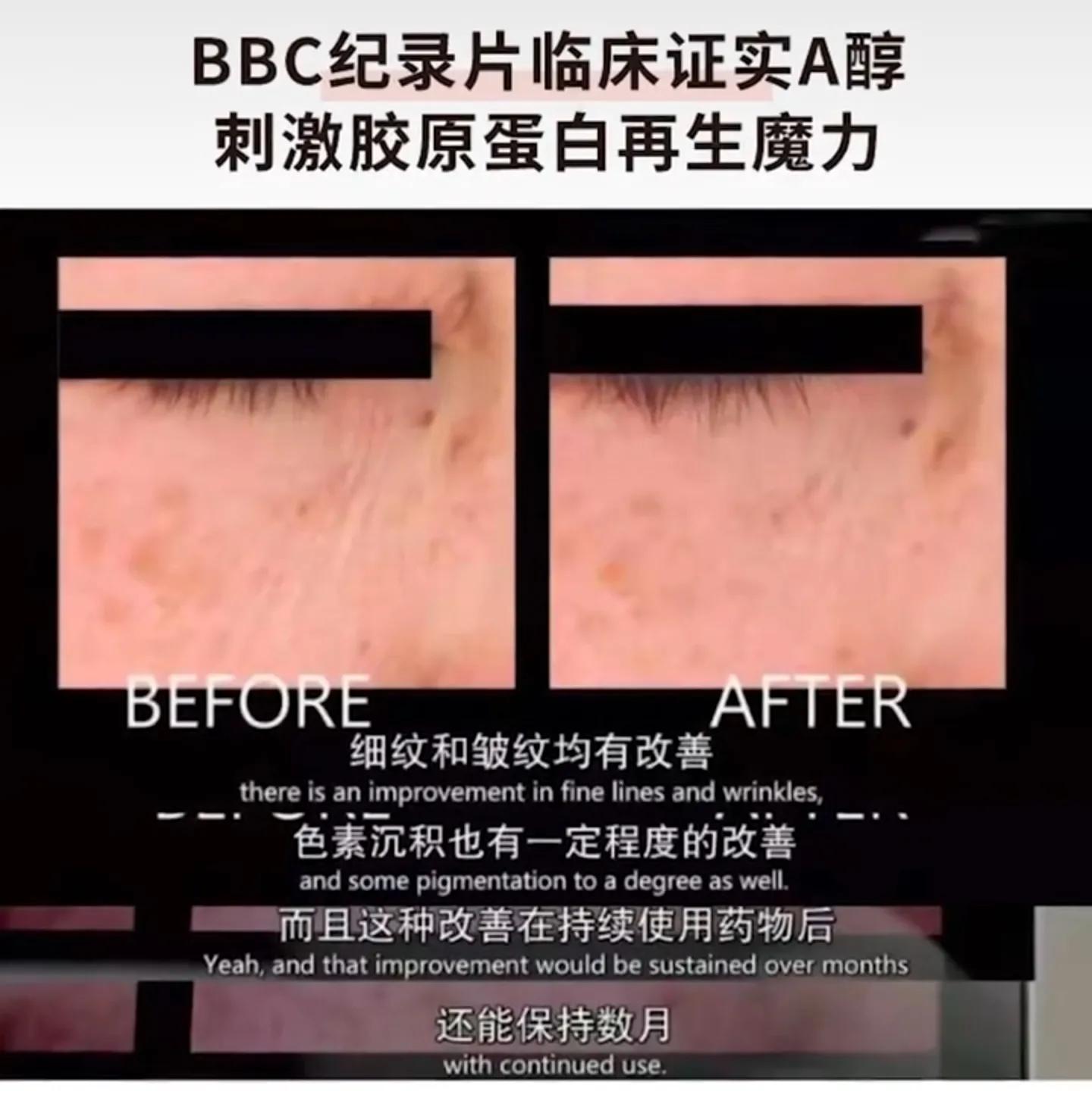 眼霜国货老牌子视黄醇,抗黄护肤品推荐