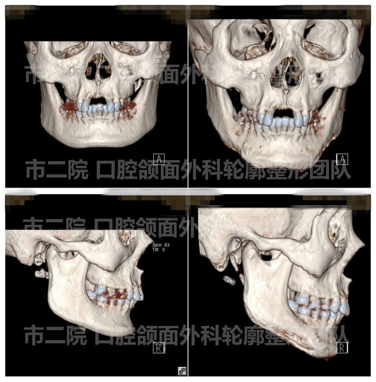 娣卞湷棰岄潰澶栫鏁村舰,娣卞湷鍙ｈ厰鍖婚櫌棰岄潰鏁村舰