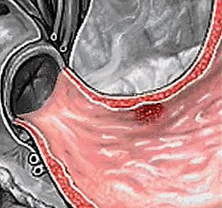 别人有口臭你怎么告诉他,我该不该告诉好朋友他有口臭