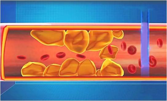 各个年龄段血压心率对照表,超敏c反应蛋白正常值对照表