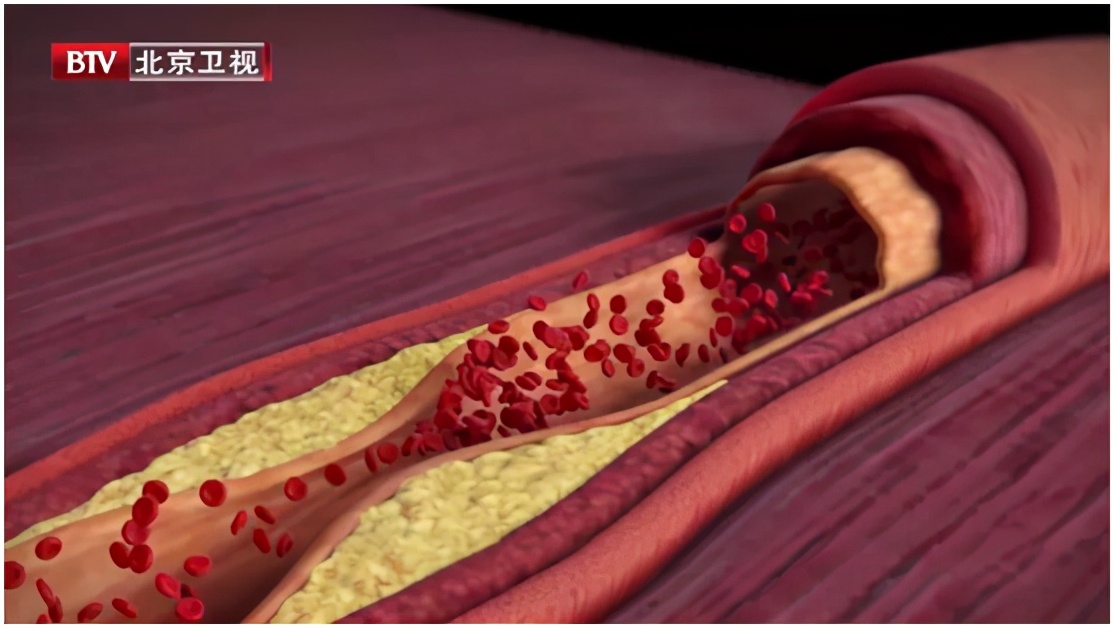 这些炎症可能比癌症更可怕，发病快、致死率高！用好餐桌上的“天然消炎剂”，给身体“消消炎”