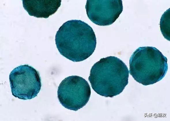 糖尿病磁疗穴位贴,磁疗治疗糖尿病最新成果