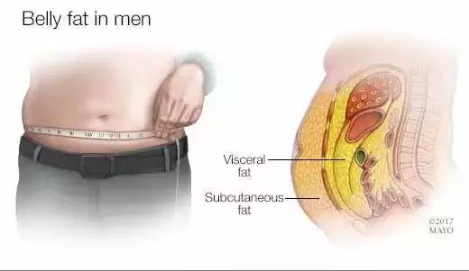 肚子突出屁股后翘正常吗,肚子大腰弯屁股翘怎么矫正