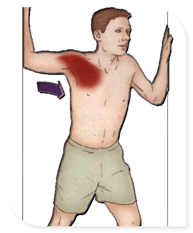 如何解决含胸驼背问题,你含胸驼背的样子