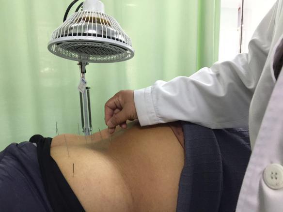 产后康复是怎么做的,中医康复和产后康复哪个最好