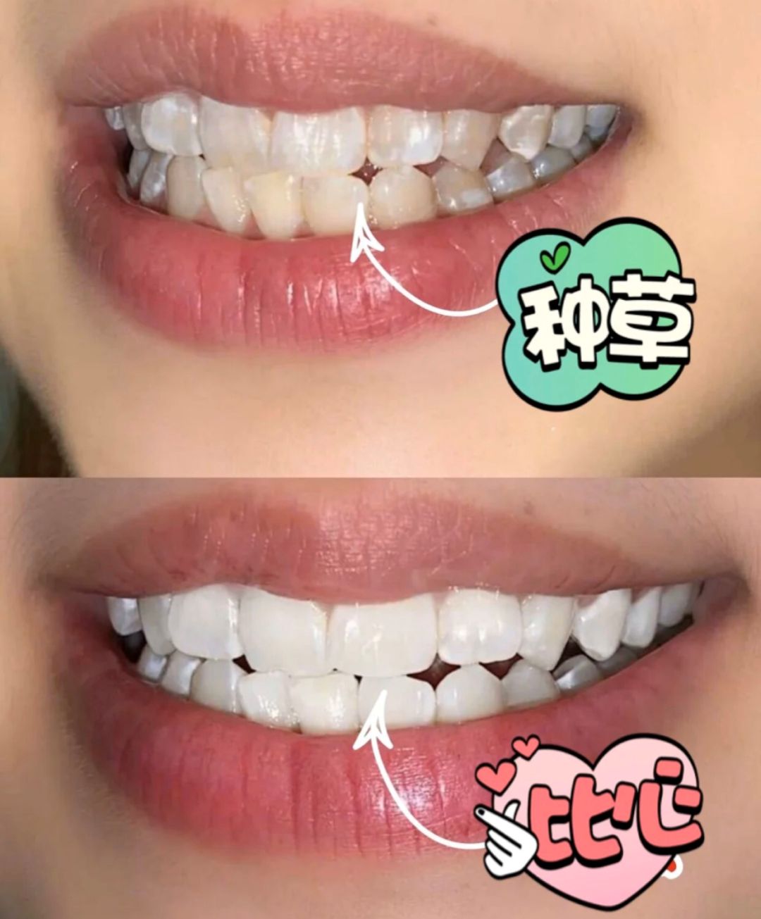 口腔专用香水,能持久留香的口腔香水