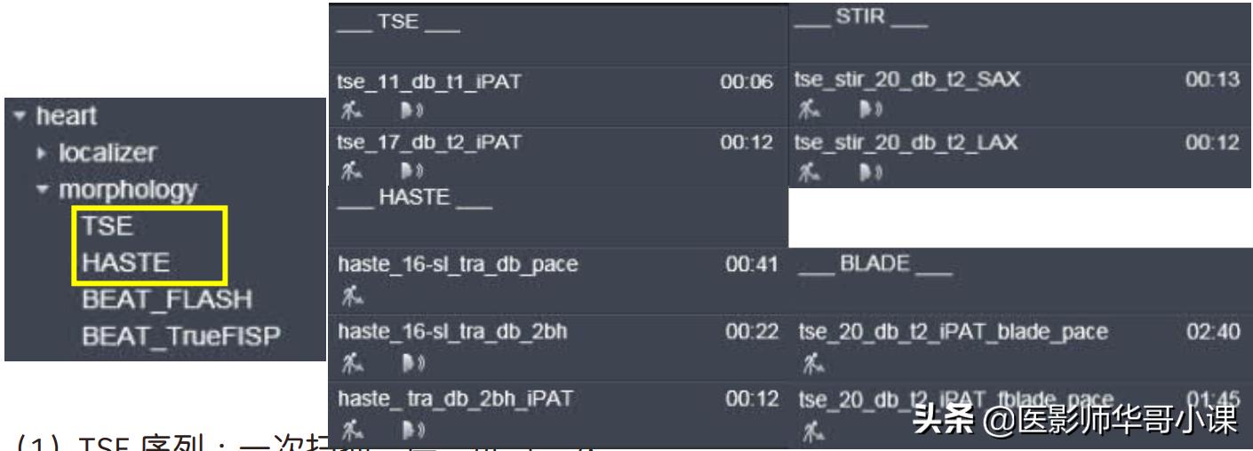 磁共振心脏扫描标准切面,心脏mri扫描定位