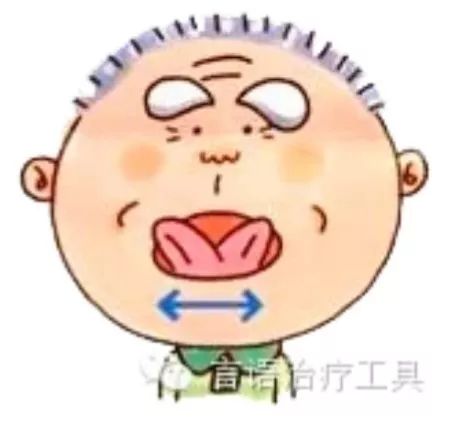 如何制定吞咽障碍康复治疗计划,言语吞咽障碍康复训练