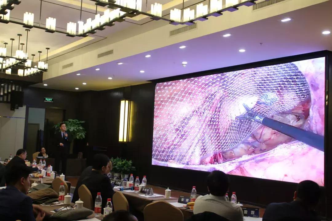 荣耀时刻！掌声送给我们腔镜疝修补的能手们......