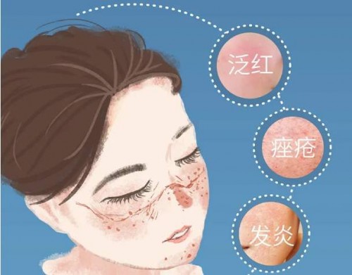 戴口罩脸颊泛红长痘,敏感皮肤戴口罩长了很多痘