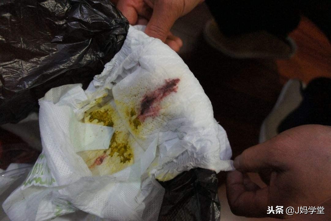 新手父母一定要掌握的9个换纸尿裤技巧，宝宝屁股干爽不遭罪