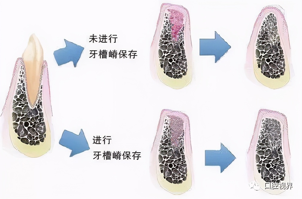 鑱婅亰鎷旂墮鐨勯偅浜涗簨鍎挎湳鍚庢仮澶嶇瘒,30骞存嫈鐗欏疄鎴樼粡楠屽垎浜嫈鐗欑柤涓嶇柤