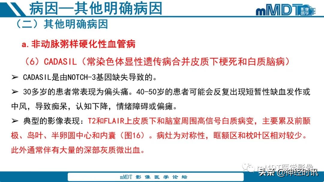 缺血性脑卒中护理课件,缺血性脑卒中讲课ppt