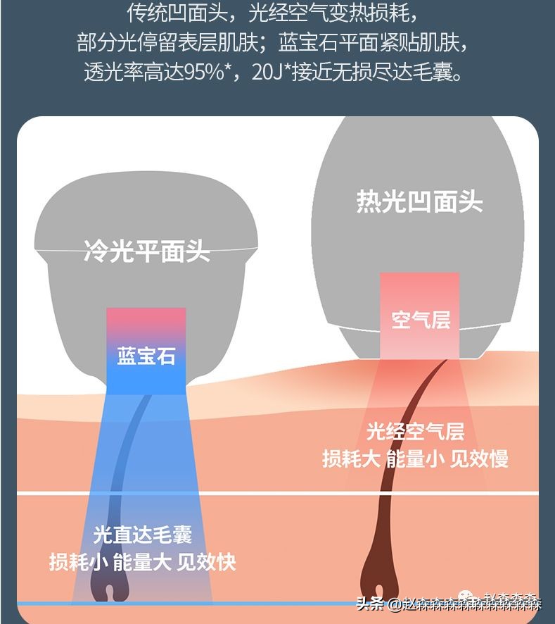脱毛仪ulike和牛奶光美容仪的区别,beautigo奶冻脱毛仪和ulikeair3哪个好