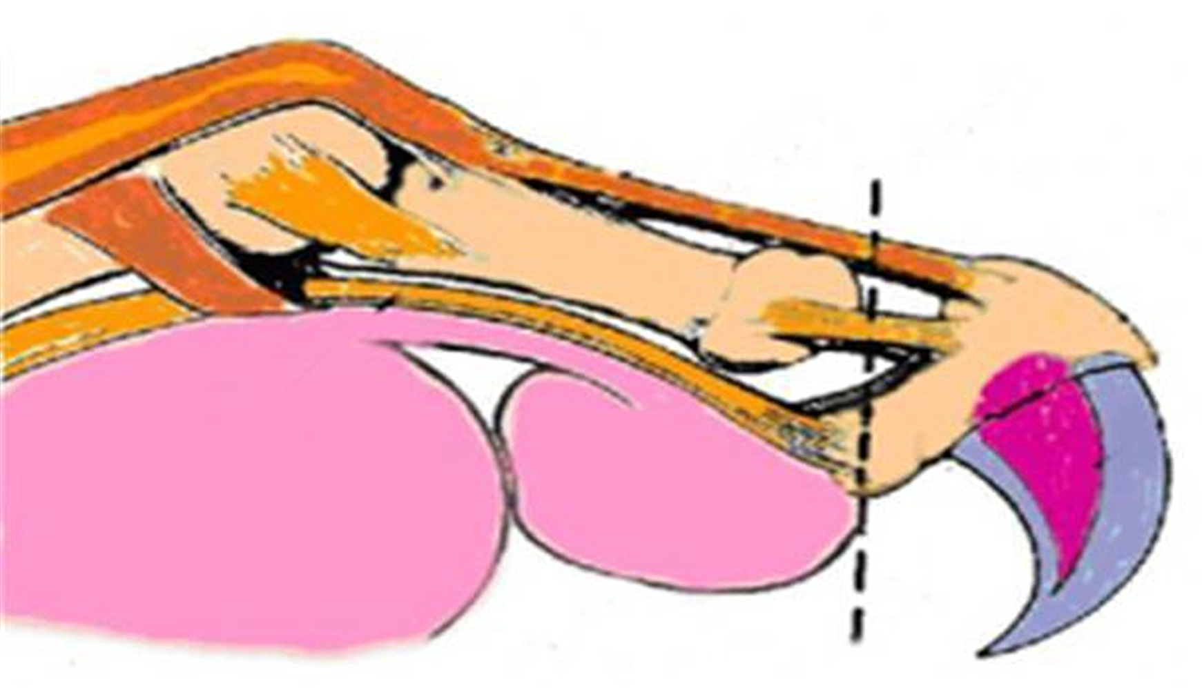 被猫抓伤确诊猫抓病,被猫咪抓了会得猫瘟吗