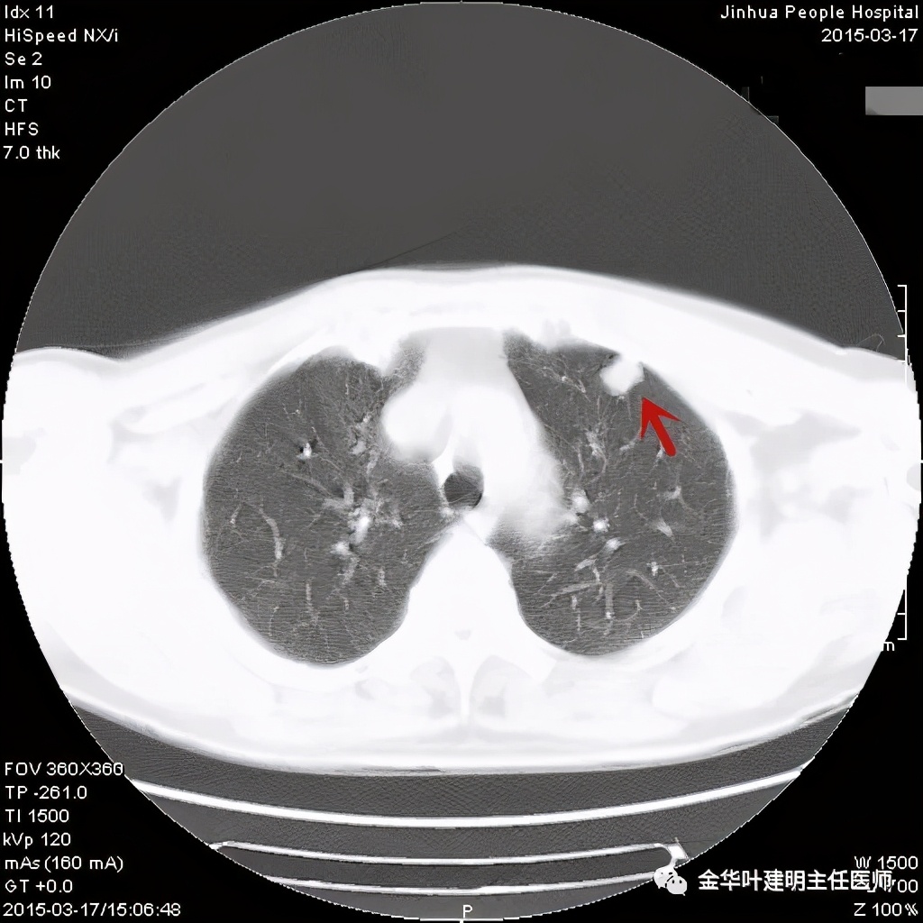 误诊报告图片,误诊案例及案例分析