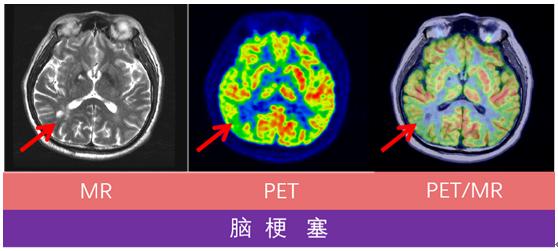哈医大一院磁共振有片吗,哈医大一院能做内耳磁共振吗