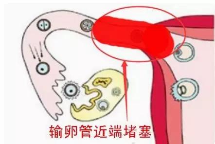 为什么怀个孩子那么难？或许是这几个原因导致的
