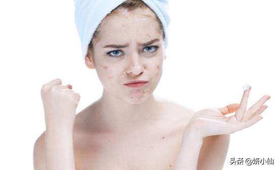 下巴长闭合性粉刺去除的方法,下巴白头粉刺是什么原因引起的