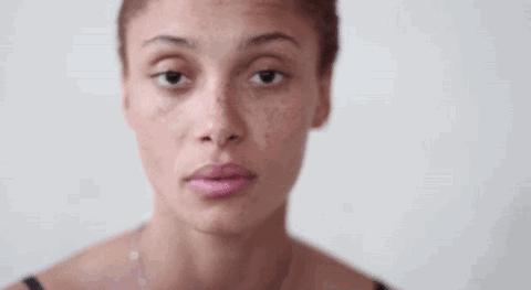 要肌肤像剥了壳的鸡蛋？你对斑了解多少？