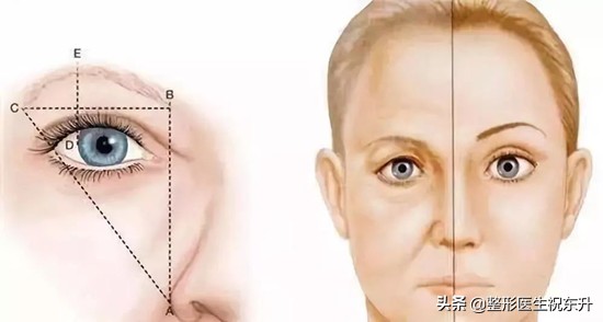 妈妈想做眉毛,哪些人群适合做提眉