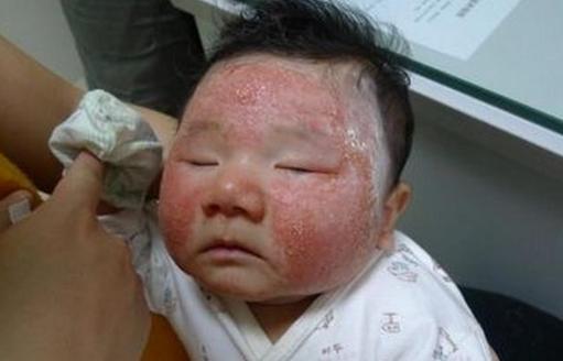 孕晚期吃鹅蛋怎么解胎毒,孕晚期吃鹅蛋可以去胎毒吗