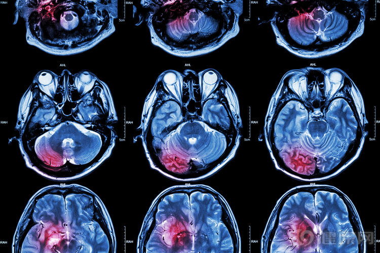 肝不好心烦气躁怎么调理,肝气郁滞导致的口苦