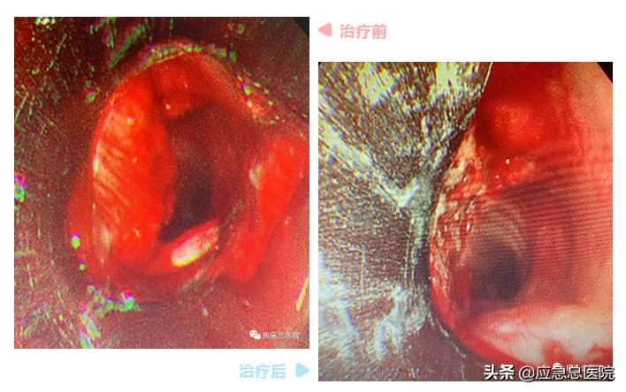 多学科联合手术救治患者,多学科联合抢救病人