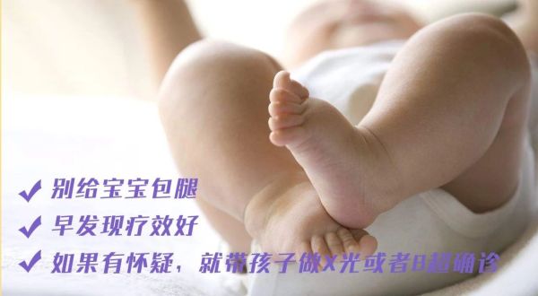 新生儿臀纹不对称双腿一样长,宝宝双腿纹路不对称有没有影响