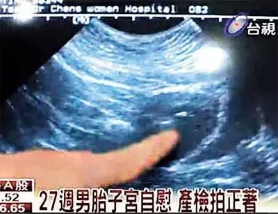 2宀佸┐鍎垮す涓よ吙,2宀佸皬瀛╁す灏忚吙