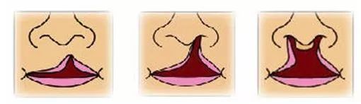 新生儿科普知识小视频,为什么我的宝宝会有唇腭裂