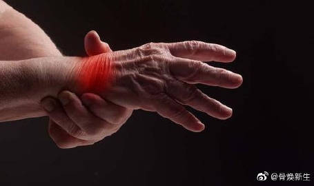 关节疼风湿怎么治疗完全治愈,关节疼是不是风湿病查啥