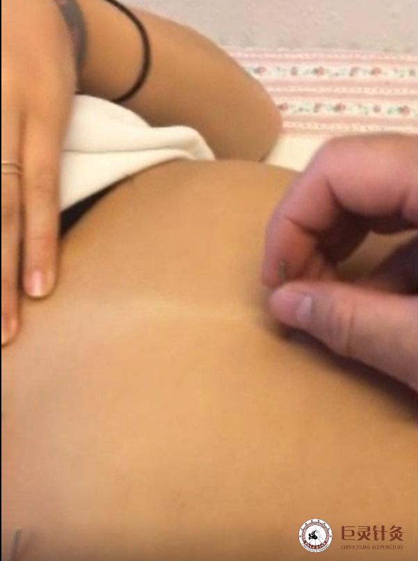 肚子中脘痛是怎么回事,饭后左边肚子疼中医辨证