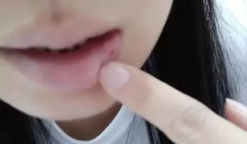 维c对肝脏有保健功效吗,多补维c可以去肝火吗